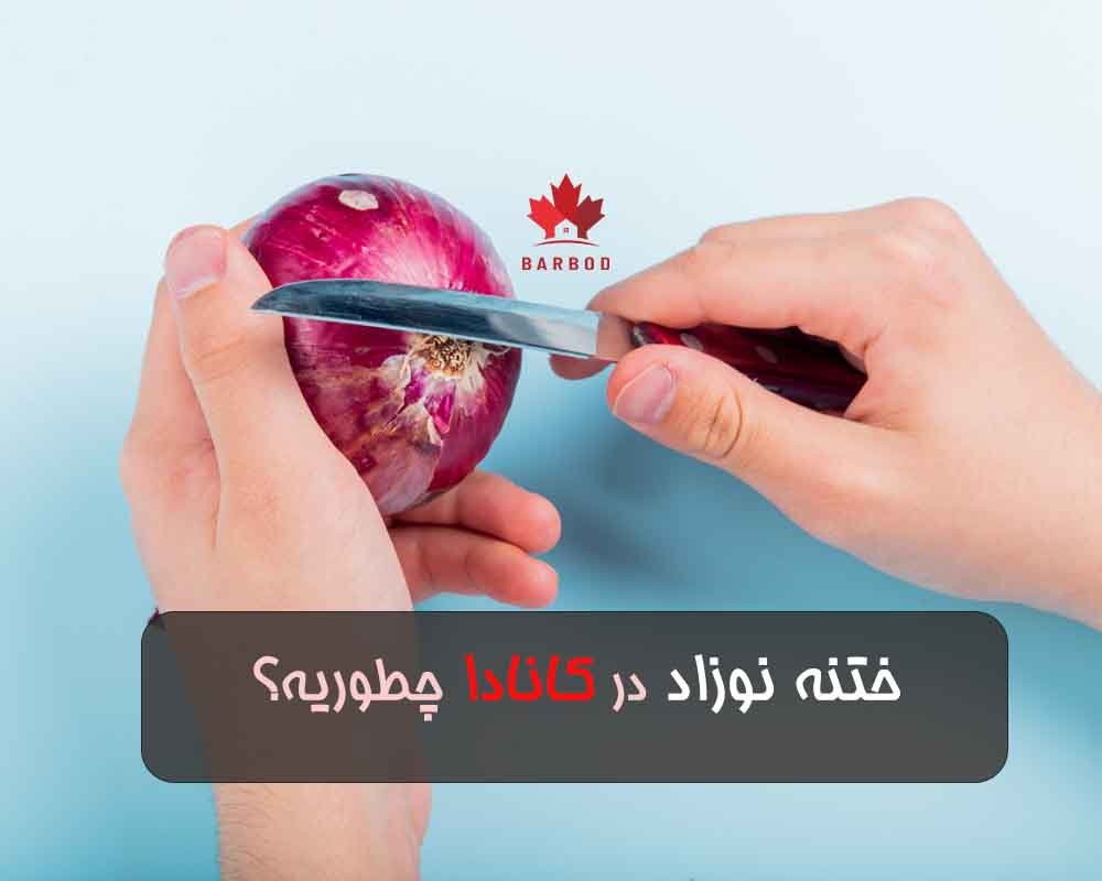 ختنه در کانادا کی انجام میشه و چطوریه 